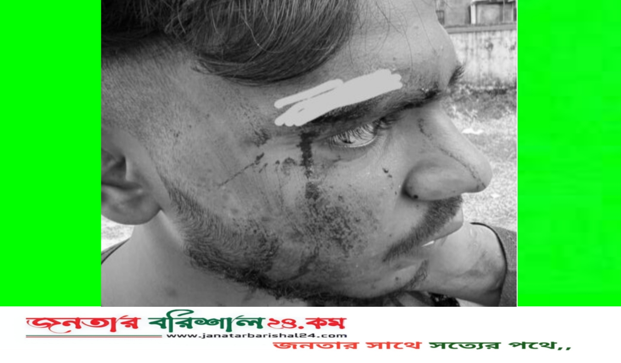 আগৈলঝাড়ায় বিএনপির দুই প্রার্থীর সমর্থকদের সংঘর্ষে কলেজছাত্র আহত