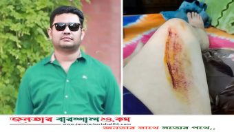 সড়ক দুর্ঘটনায় আহত  উপজেলা যুবদলের সদস্য সচিব আলী হায়দার