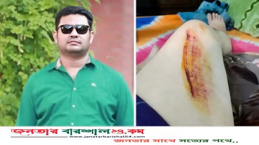সড়ক দুর্ঘটনায় আহত  উপজেলা যুবদলের সদস্য সচিব আলী হায়দার