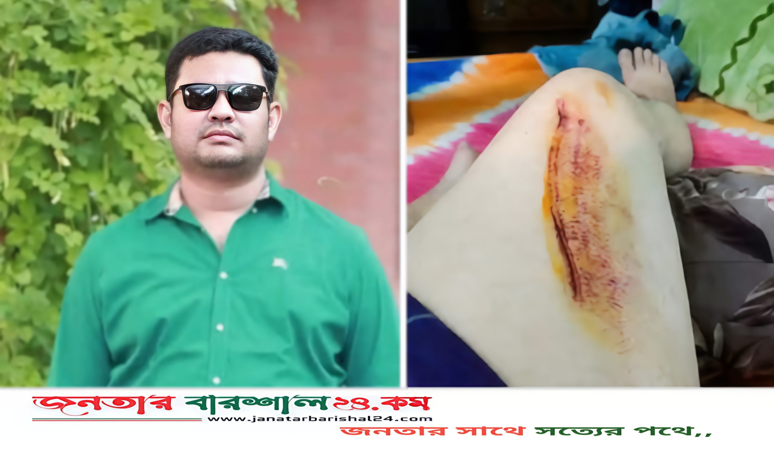সড়ক দুর্ঘটনায় আহত  উপজেলা যুবদলের সদস্য সচিব আলী হায়দার